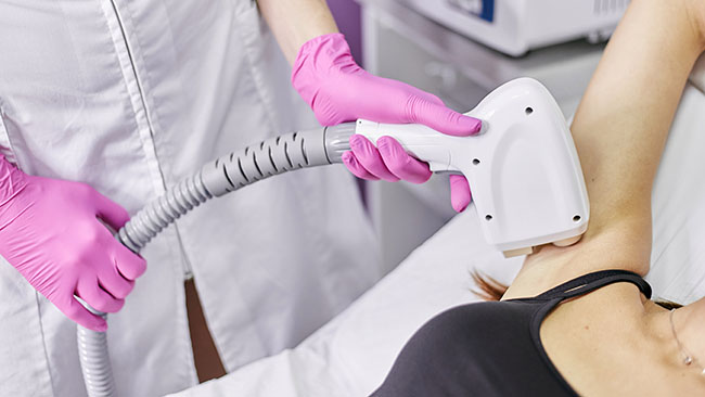 epilare definitiva Iasi